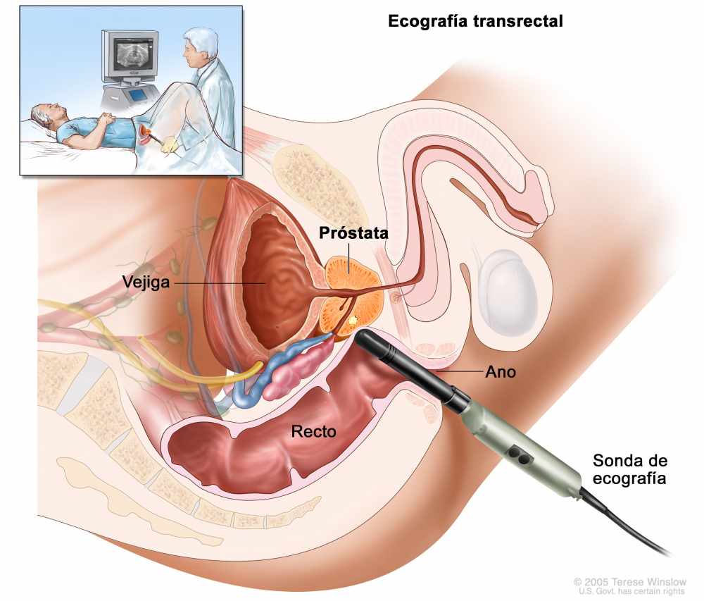 cura preventiva prostata)